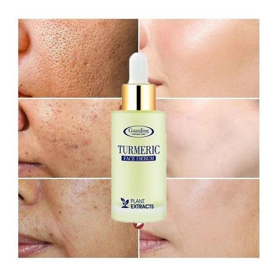 Pack2 (Sérum, savon), ensemble curcuma soins de la peau, hydratant et nettoyant