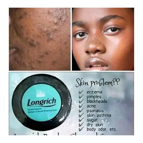 Savon anti tache longrich
