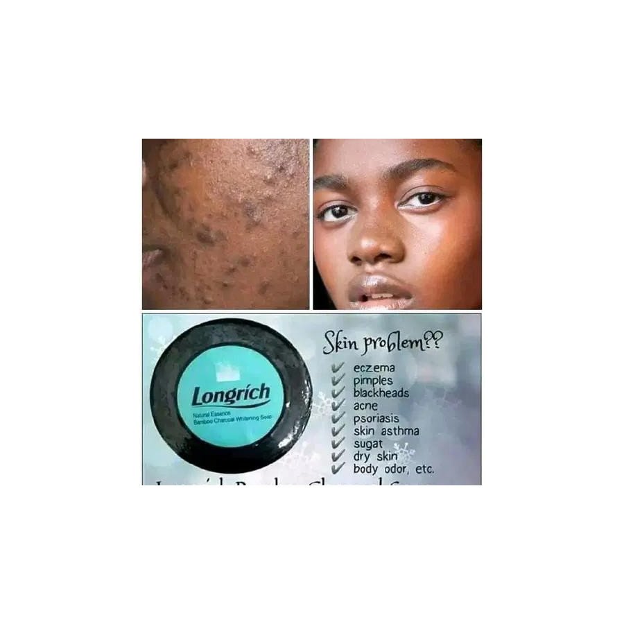 Savon anti tache longrich