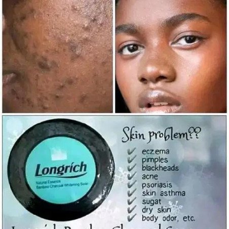 Savon anti tache longrich